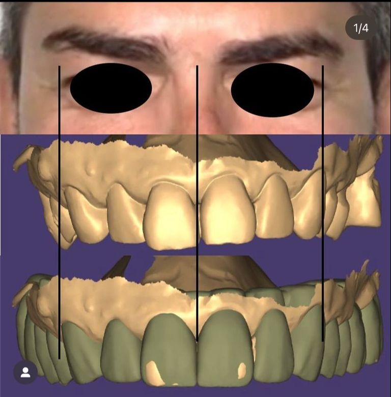 Curso para Dentistas en formación