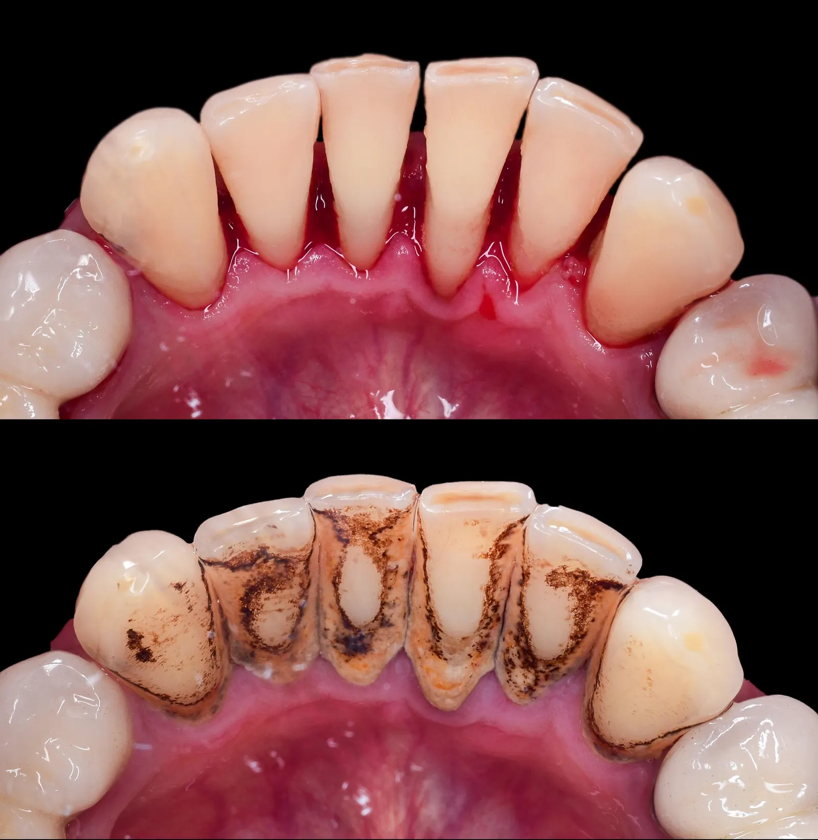 Periodoncia